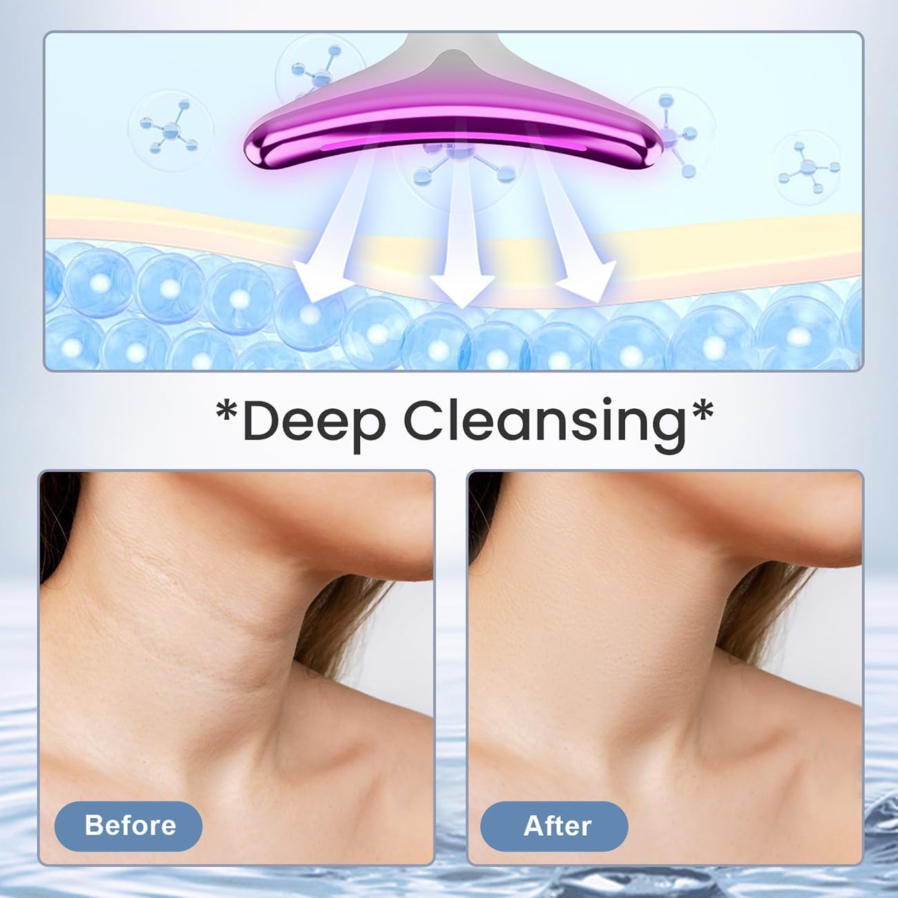 Anti Wrinkle Beauty Apparatus