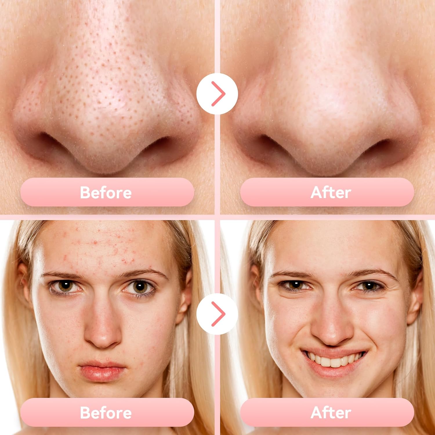 Electric Black Head Suction Instrument Face Cleaner